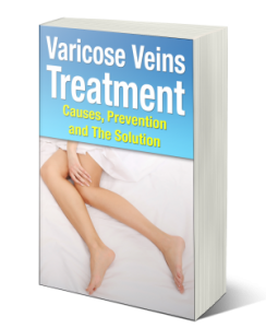 varicose veins